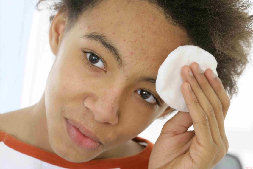 Teen cleaning face with cotton pad.