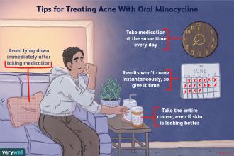 Tips for treating acne with oral minocycline