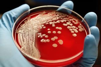 MRSA bacterial colo<em></em>nies in a petri dish.