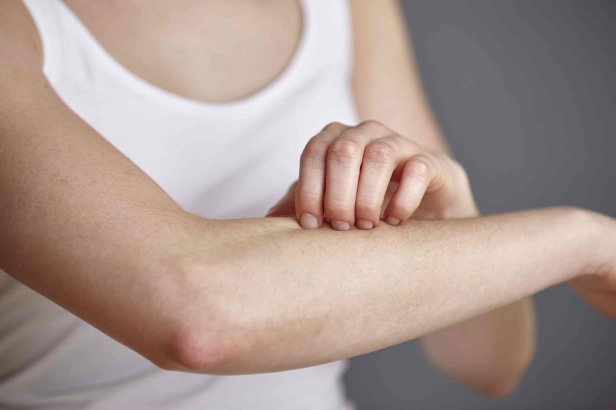 Woman scratching her skin on her arm