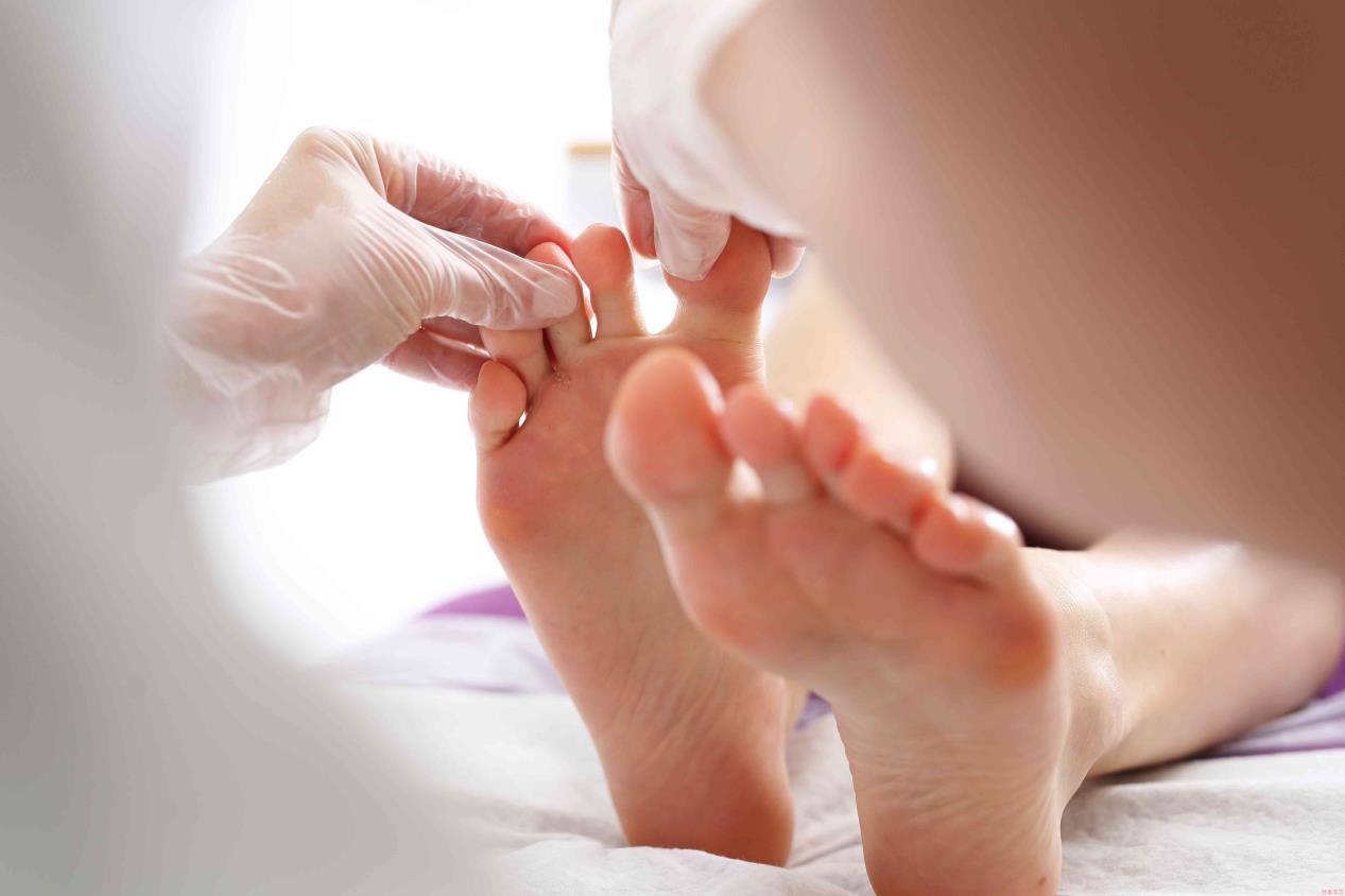 Toe and nail fungus. Woman at a dermatologist.