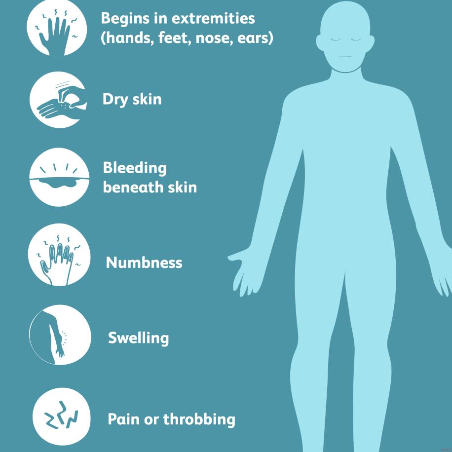 Symptoms of gangrene