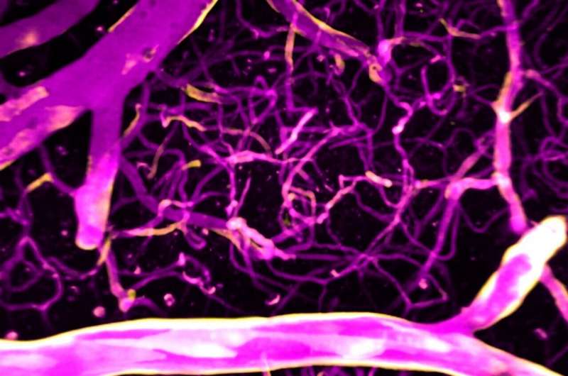Study finds calcium precisely directs blood flow in the brain