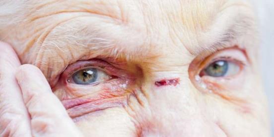 Abuse of the elderly in Norway is widespread