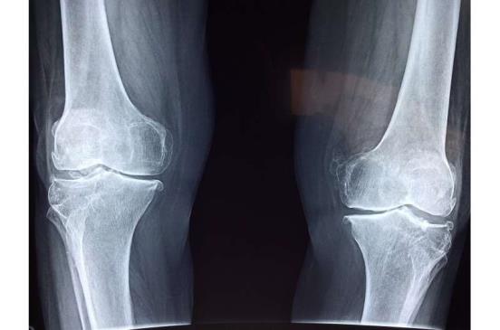 knee cartilage