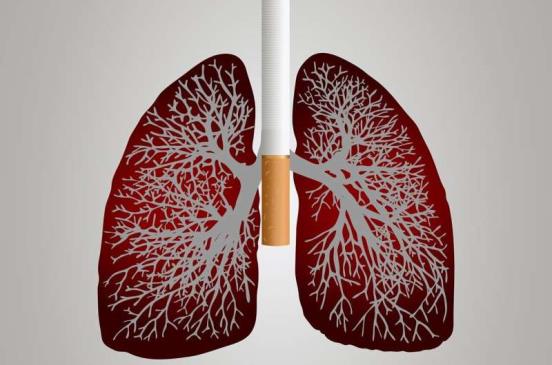 一项新的研究强调了澳大利亚在肺癌护理方面的主要不足