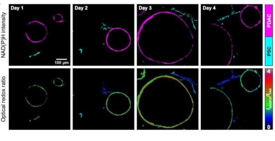 Optical imaging highlights me<em></em>tabolic interactions that make pancreatic tumor cells grow