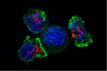 研究团队发现CAR - T细胞在实体肿瘤中的新靶点