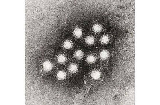 在不明原因的儿童肝炎病例背后可能有什么原因?