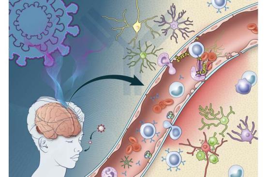 一项小型研究揭示了COVID-19引发的免疫反应可能会损害大脑