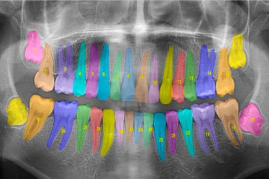 用人工智能让牙齿护理不再需要猜测