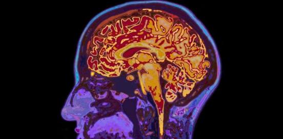 青少年的“大脑指纹”可能能够预测未来的心理健康问题