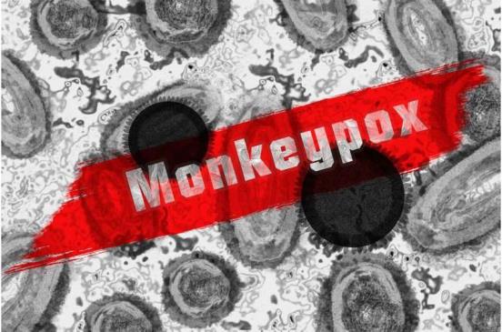 缺乏高质量的猴痘指南可能会阻碍全球的治疗