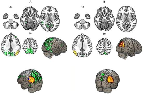 神经语言学家报告了大脑功能分类的三个选项，而不是两个