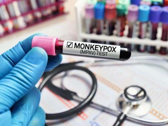 U.S. mo<em></em>nkeypox cases are declining